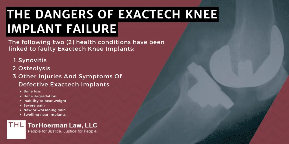 The Dangers Of Exactech Knee Implant Failure