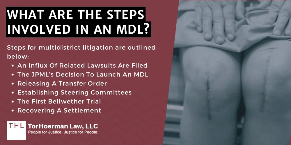 What Are The Steps Involved In An MDL