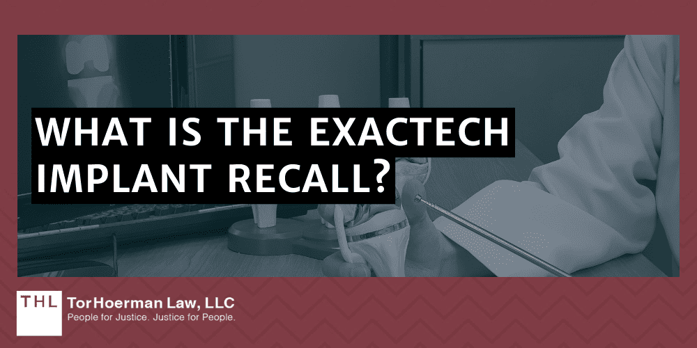 What Is The Exactech Implant Recall