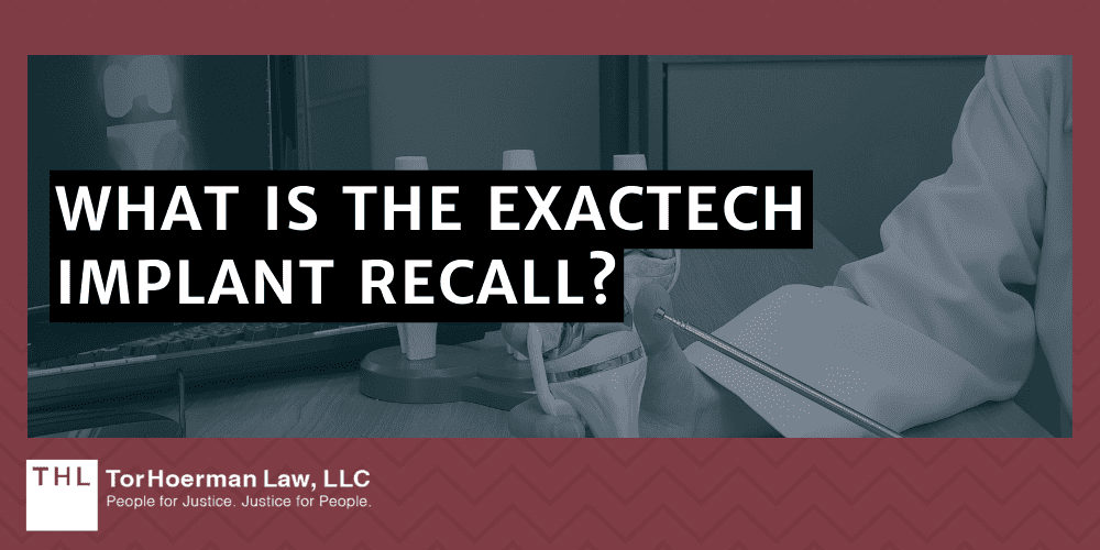 Exactech Knee Replacement Lawsuit; Exactech Knee Replacement Recall Lawsuit; Exactech Implant Recall Lawsuits; Exactech Recall; Exactech Knee Implant Lawsuit; Exactech Lawsuit; Exactech Lawsuits; Exactech Lawyers; Exactech MDL; What Is The Exactech Implant Recall