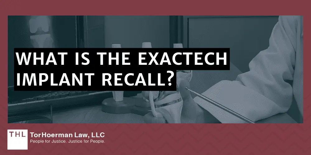 What Is The Exactech Implant Recall