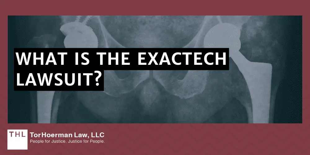 What Is The Exactech Lawsuit