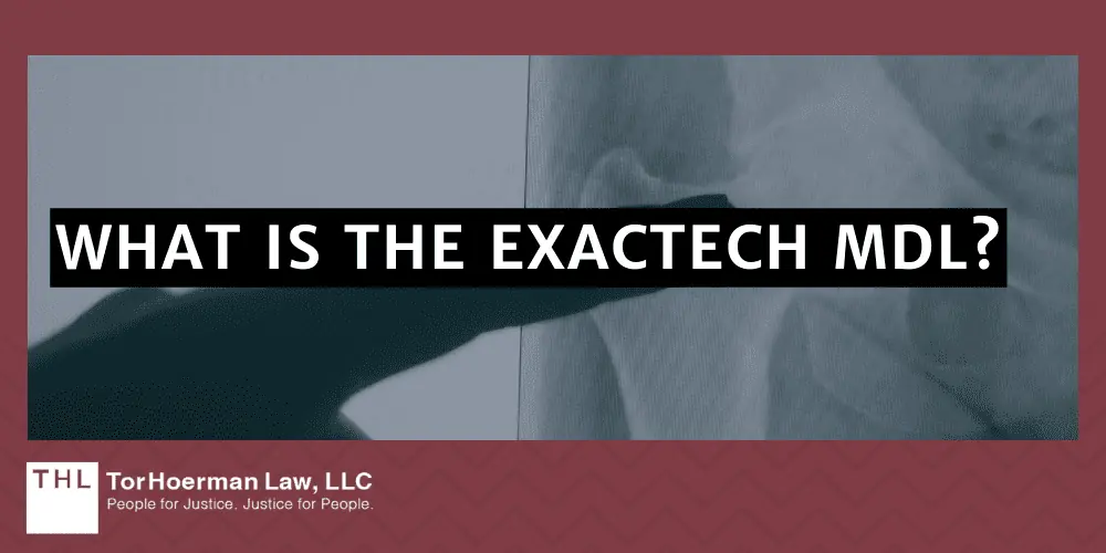 What Is The Exactech MDL