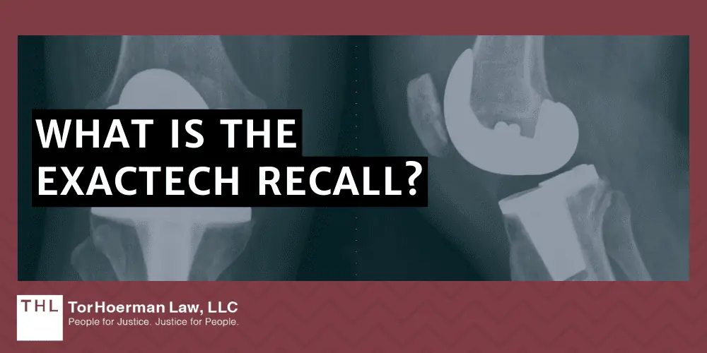 Exactech Recall FAQ What Is the Exactech MDL; Exactech MDL; Exactech Recall; Exactech Lawsuit; Exactech Recall Lawsuits; Exactech Implant Recall Lawsuits; Exactech Lawsuits; Exactech Lawyers; Exactech MDL Overview & Filing Information; The Dangers Of Exactech Knee Implant Failure; What Are The Steps Involved In An MDL; How Do MDL And Class Action Lawsuit Differ; What Is The Exactech Recall