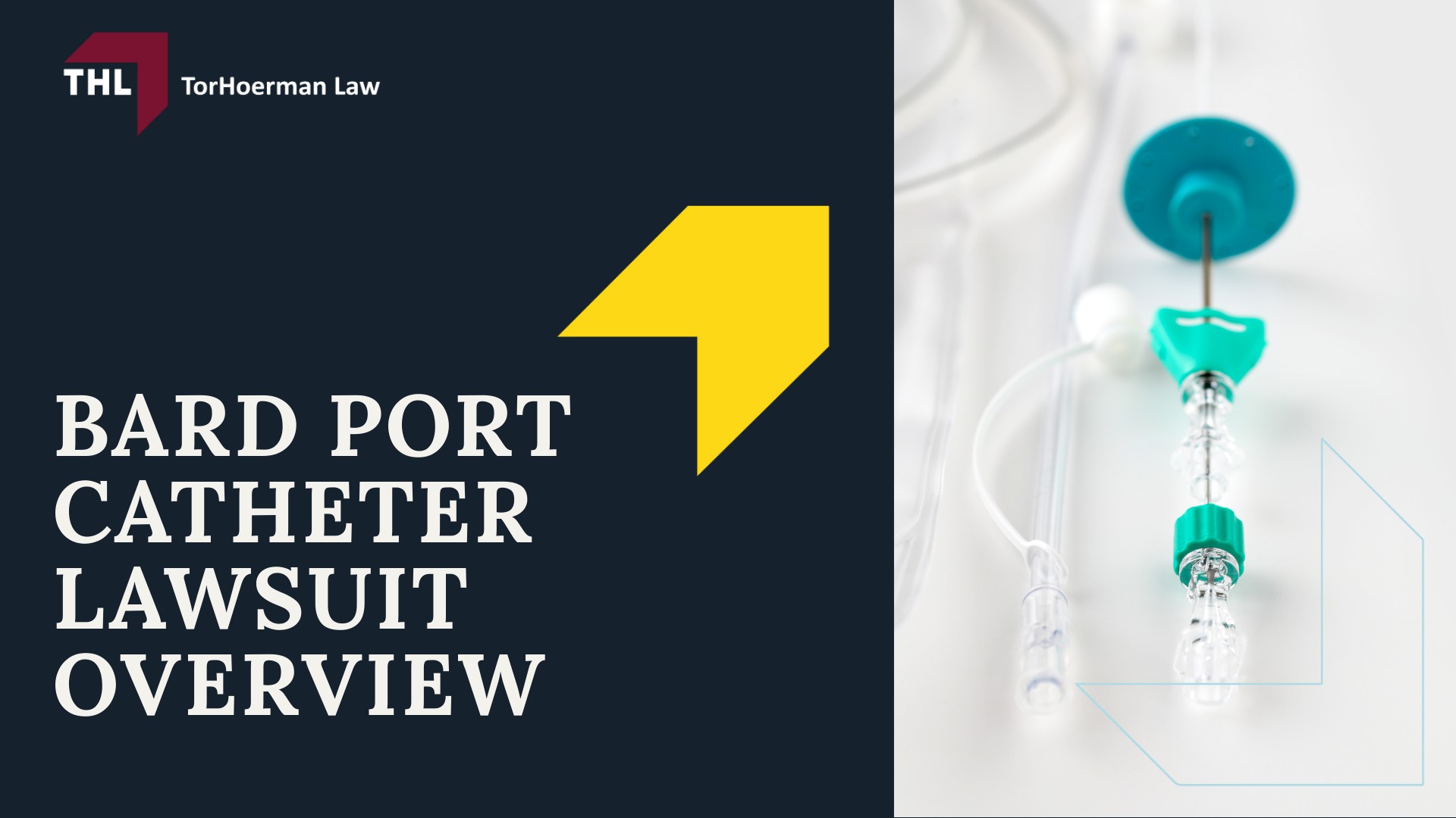 Bard Power Port Lawsuit Settlement Amounts - Projected Bard PowerPort Lawsuit Settlement Amounts - torhoerman law; Bard Power Port Lawsuit Settlement Amounts - Tier 2 Major Complications with Lasting Health Impact ($75,000 – $200,000) - torhoerman law; Bard Power Port Lawsuit Settlement Amounts - Tier 3 Moderate Injuries and Short-Term Complications ($10,000 – $75,000) - torhoerman law; Bard Power Port Lawsuit Settlement Amounts - Bard Port Catheter Lawsuit Overview - torhoerman law