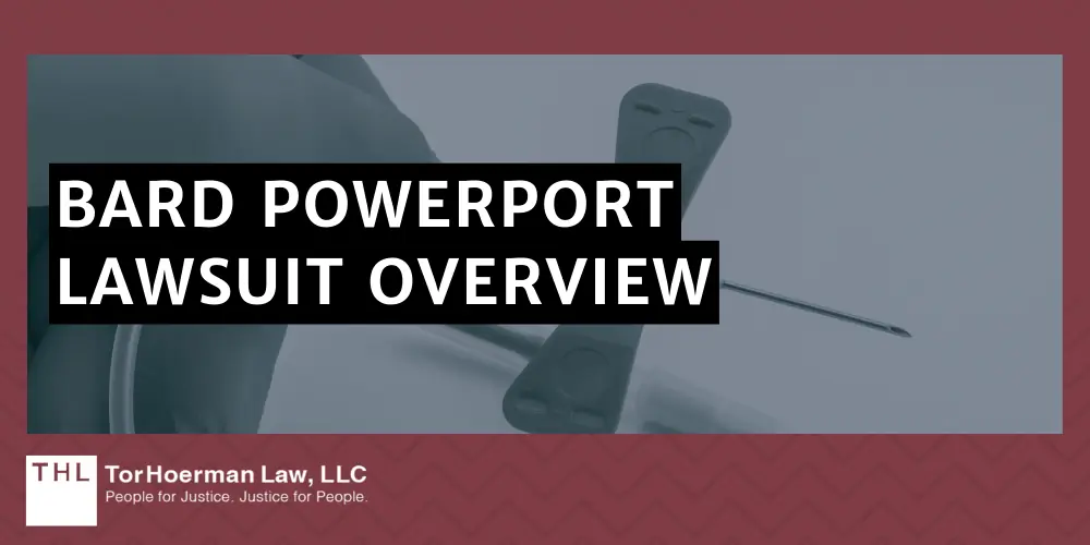 Bard PowerPort Lawsuit Overview