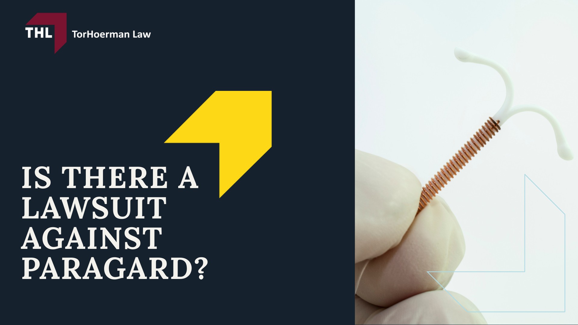 Is There a Lawsuit Against Paragard?