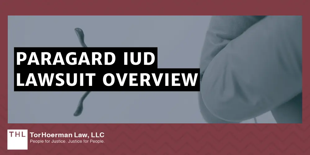 Paragard IUD Lawsuit Overview