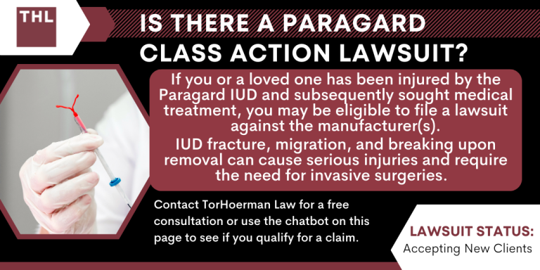 Paragard FAQ Is There a Paragard Class Action Lawsuit
