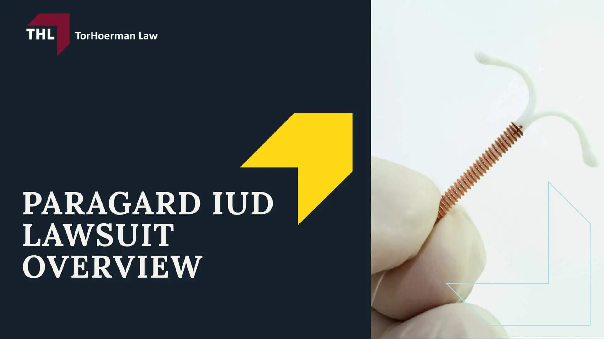 Paragard Removal Side Effects - The Dangers of the Paragard IUD_ Paragard Removal Side Effects and Injuries - torhoerman law; Paragard Removal Side Effects - Treating Paragard IUD Injuries - torhoerman law; Paragard Removal Side Effects - Paragard IUD Lawsuit Overview - torhoerman law