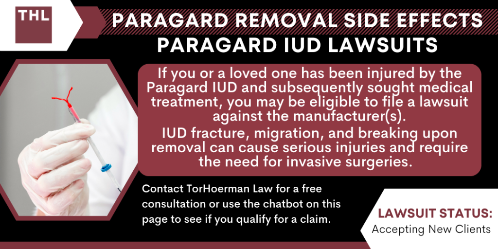 Paragard Removal Side Effects Paragard IUD Lawsuits; Paragard Removal Side Effects; Paragard Lawsuit; Paragard Lawsuits; Paragard IUD Lawsuit; Paragard IUD Lawsuits; Paragard Lawyer