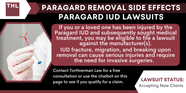 Paragard Removal Side Effects Paragard IUD Lawsuits
