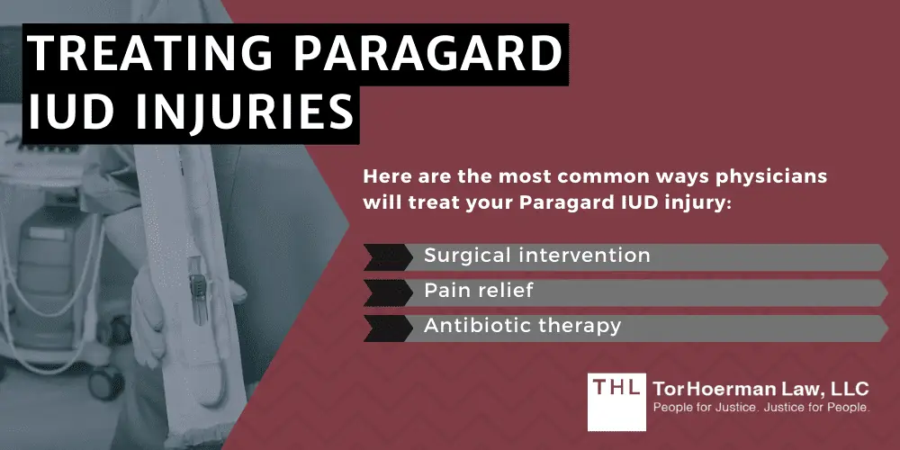 Treating Paragard IUD Injuries
