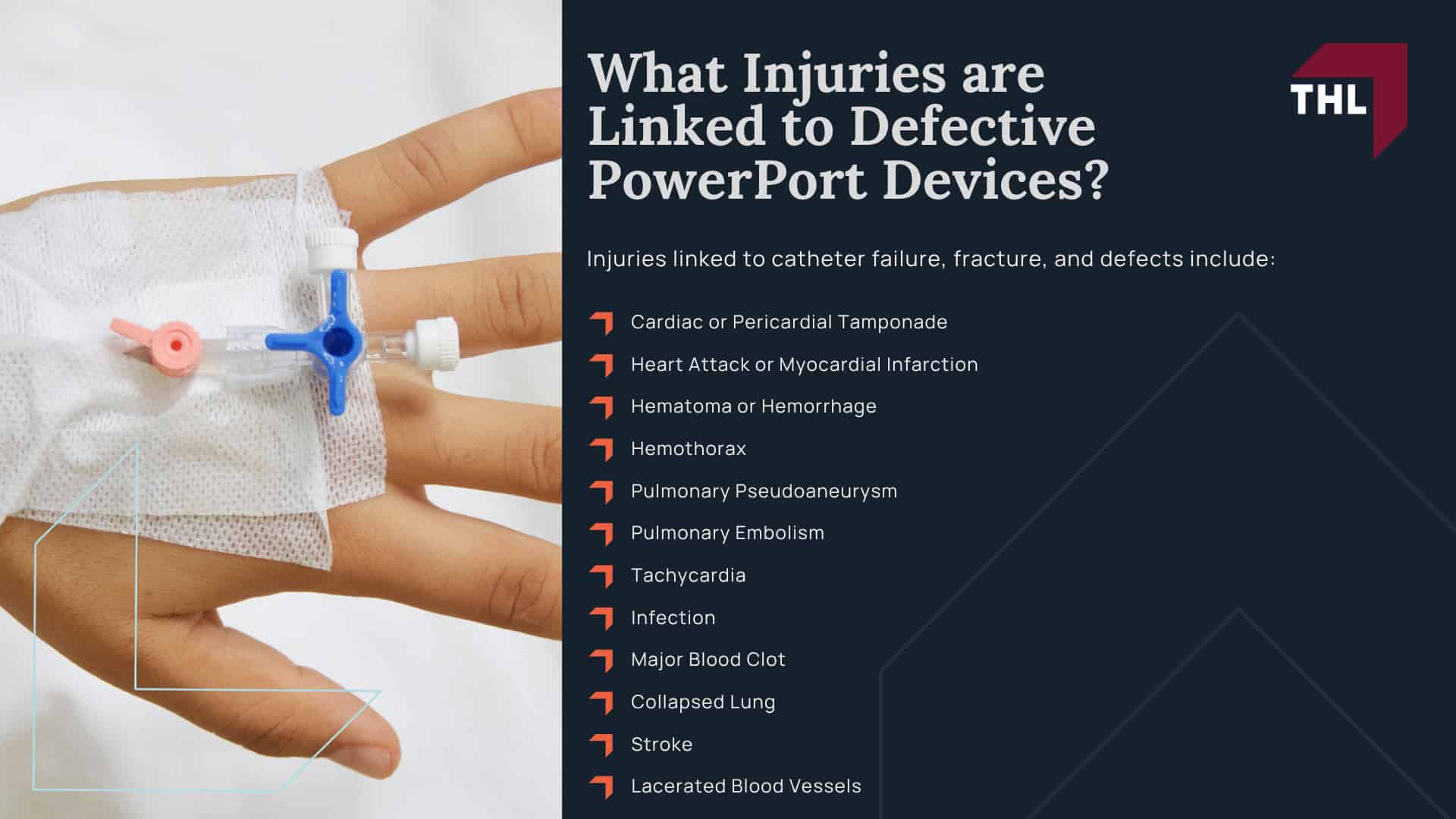 Projected Bard PowerPort Lawsuit Settlement Amounts; Bard Port Catheter Lawsuit Overview; Bard PowerPort Lawsuit Allegations; Developments in the Bard PowerPort MDL; What Injuries are Linked to Defective PowerPort Devices