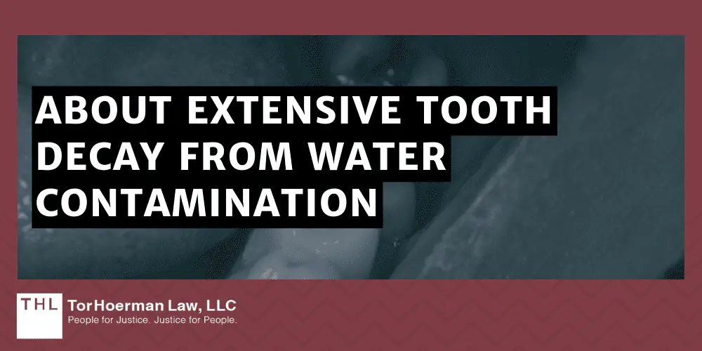 About Extensive Tooth Decay From Water Contamination