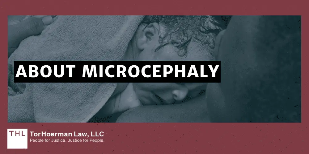 About Microcephaly