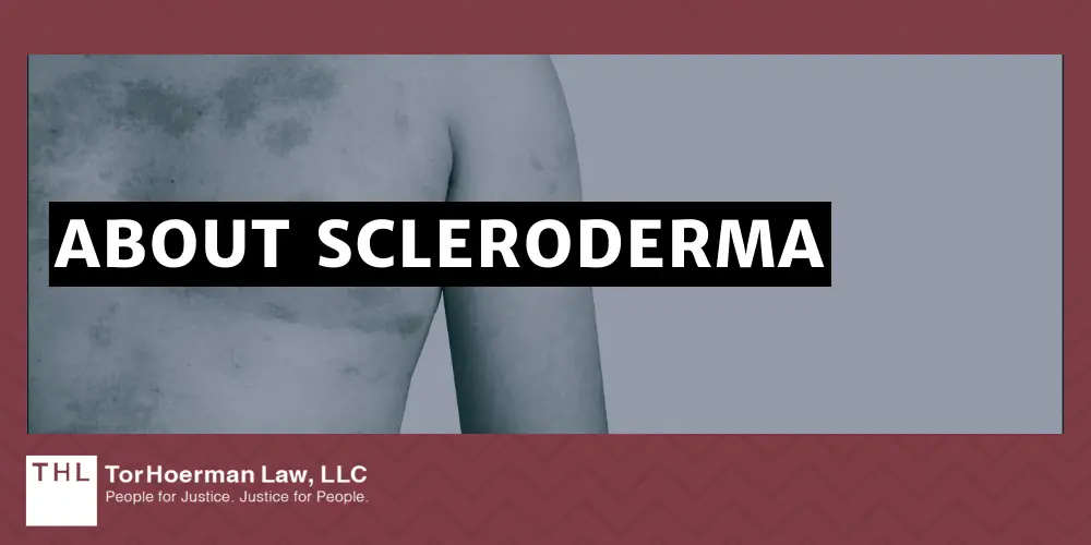 About Scleroderma