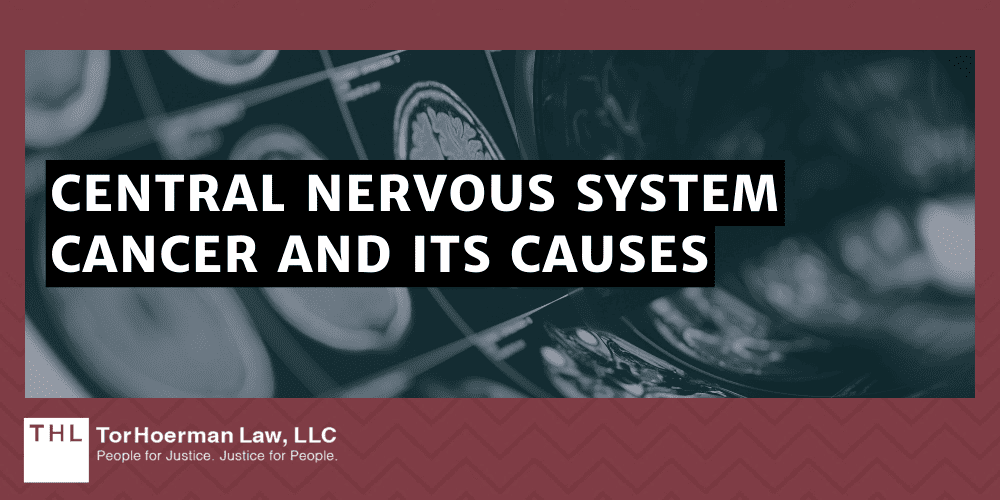 Camp Lejeune Central Nervous System Cancer Lawsuit; Camp Lejeune Lawsuit; Camp Lejeune Water Contamination Lawsuit; Camp Lejeune Lawyers; Camp Lejeune Justice Act; Central Nervous System Cancer Linked To Contaminated Drinking Water At Camp Lejeune; About Central Nervous System Cancer; Central Nervous System Cancer And Its Causes