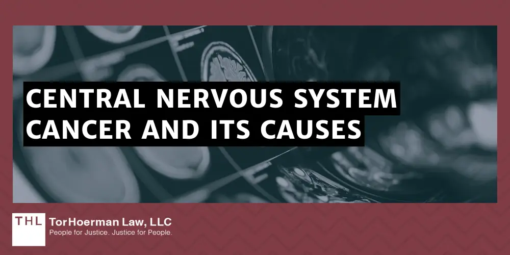 Central Nervous System Cancer And Its Causes