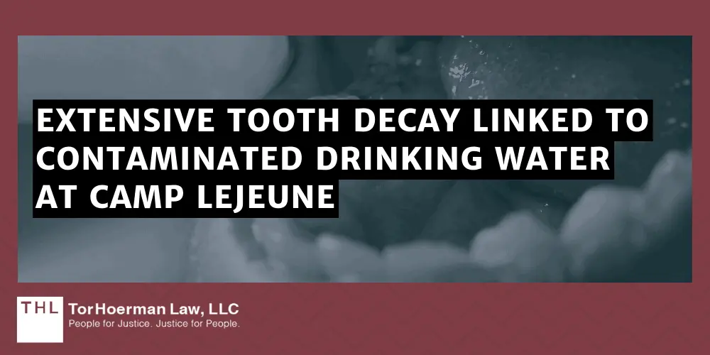 Extensive Tooth Decay Linked To Contaminated Drinking Water At Camp Lejeune