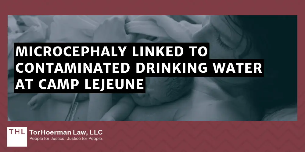 Microcephaly Linked To Contaminated Drinking Water At Camp Lejeune