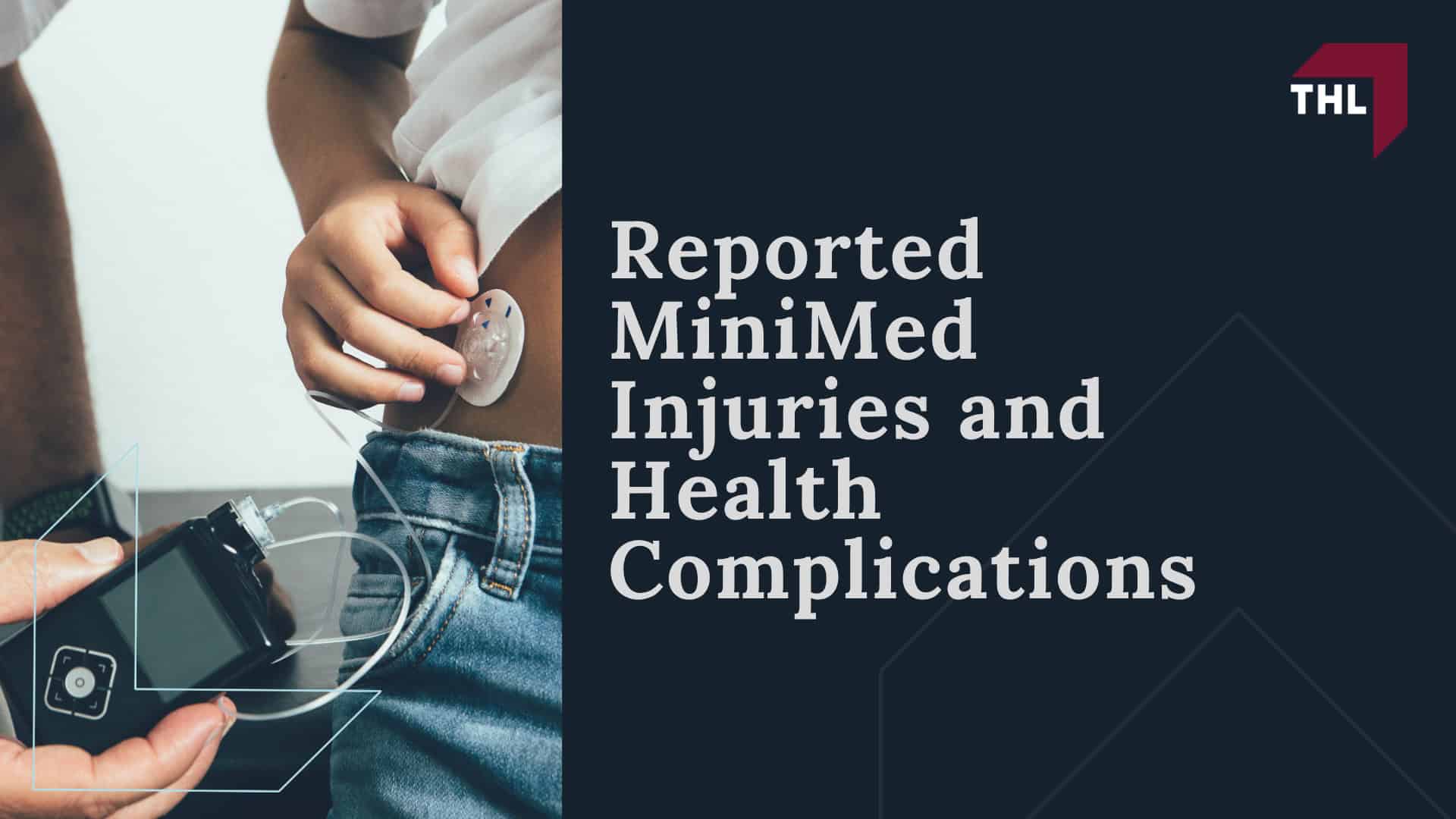 Medtronic MiniMed Insulin Pump Lawsuit Overview; Reported MiniMed Injuries and Health Complications