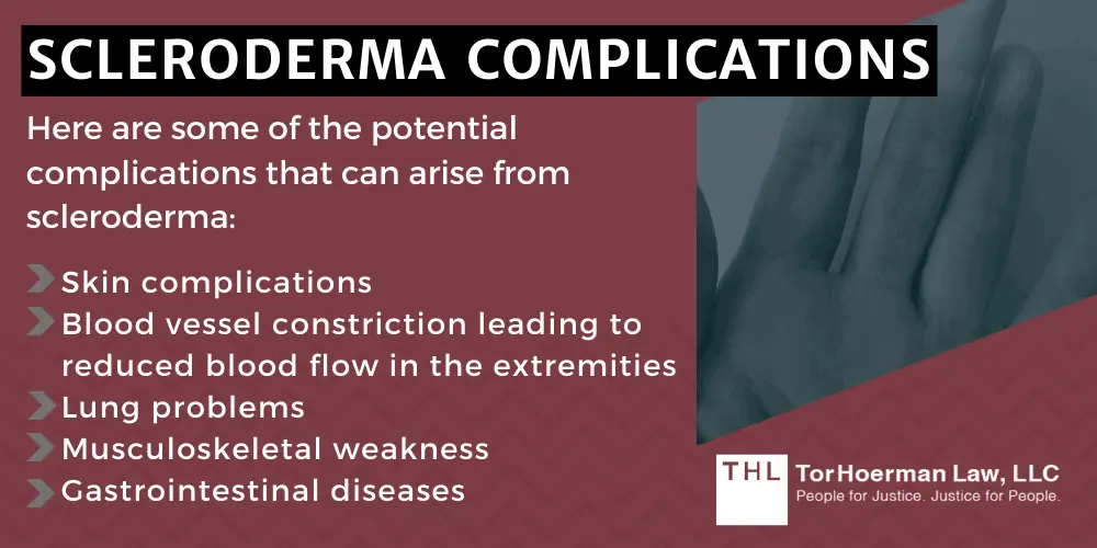 Scleroderma Complications