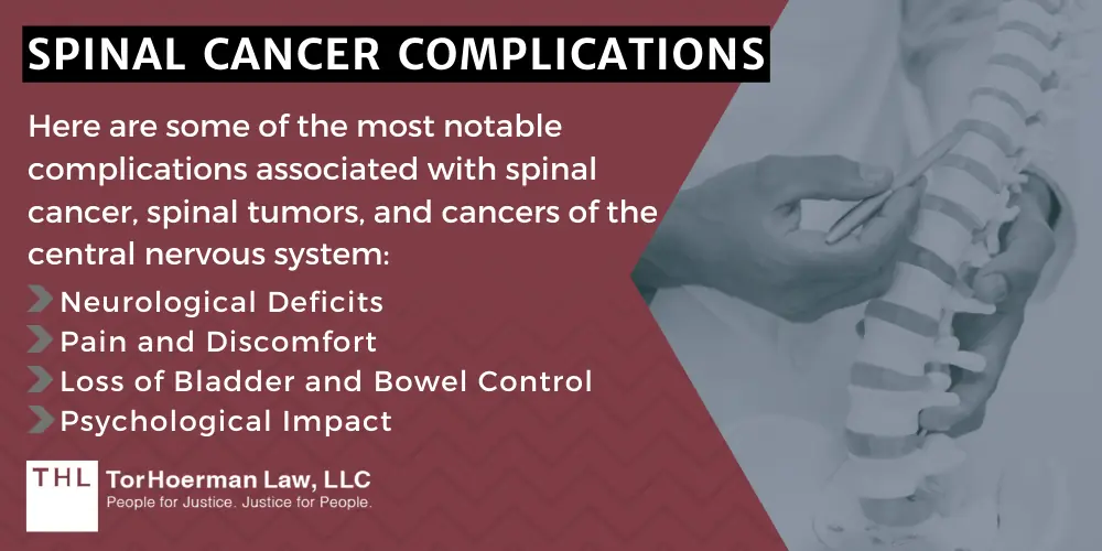 Spinal Cancer Complications