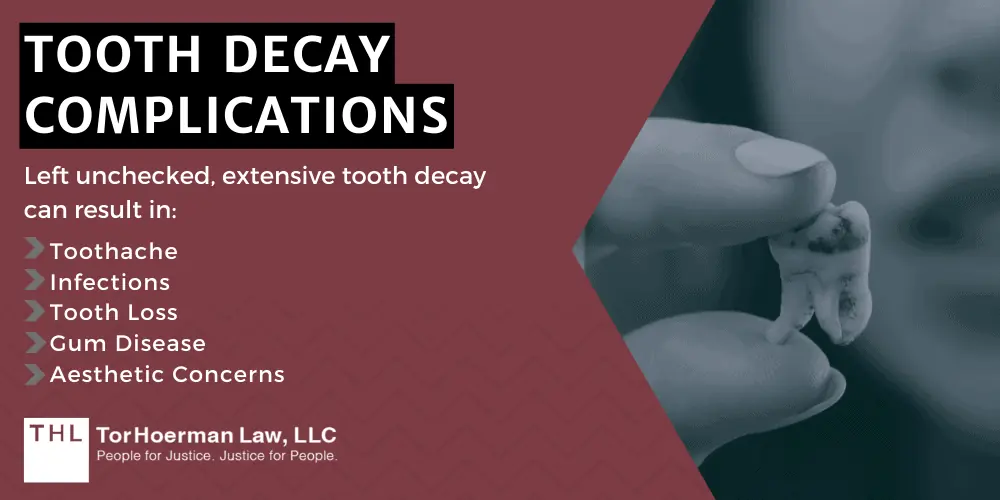 Tooth Decay Complications