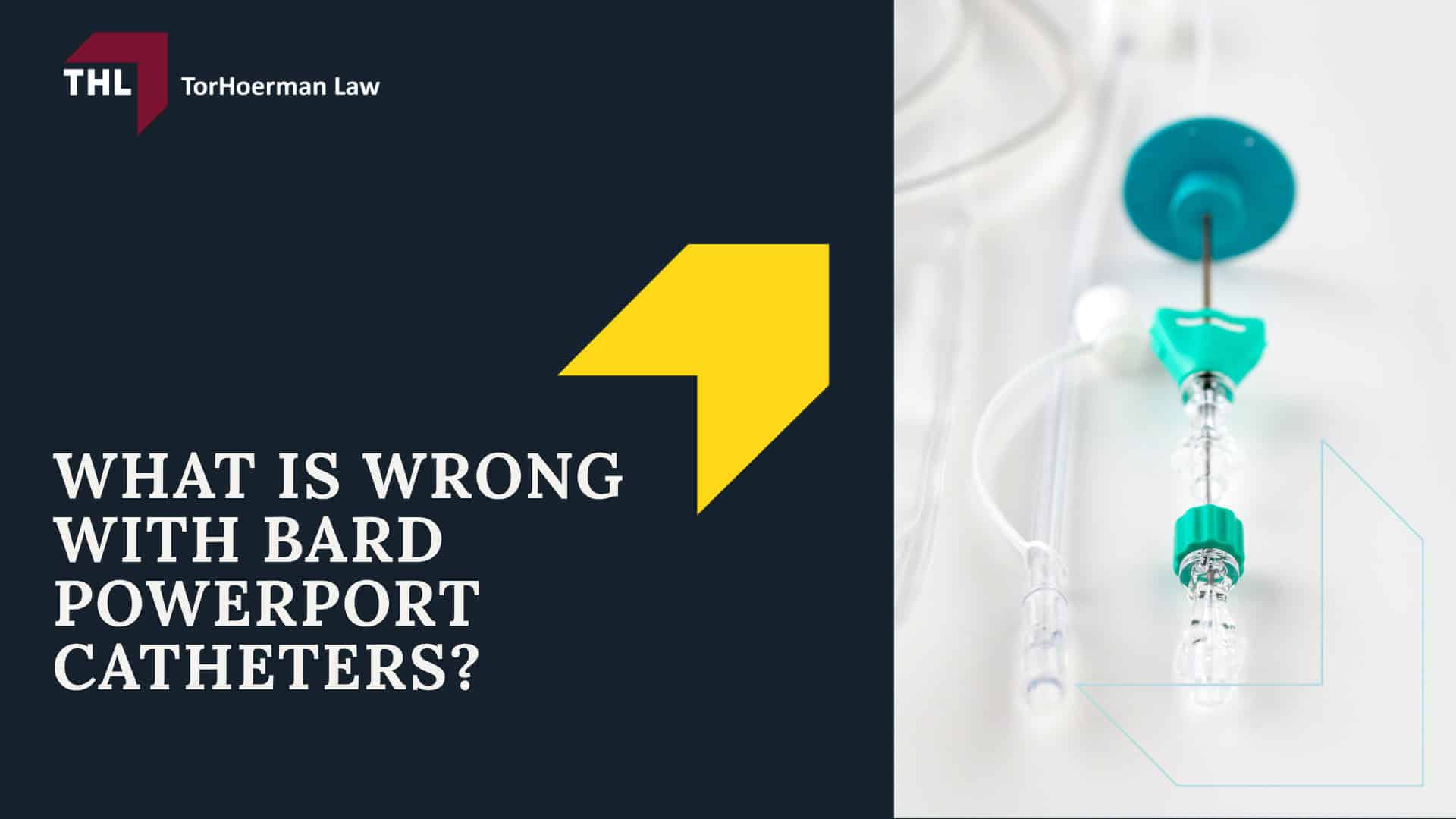 Bard Power Port Lawsuit Update and Overview; Bard PowerPort Lawsuit Allegations; What is Wrong with Bard PowerPort Catheters