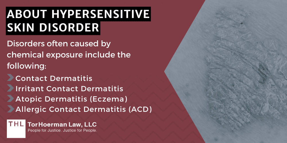 Camp Lejeune Hypersensitive Skin Disorder Lawsuit; Camp Lejeune Lawsuit; Camp Lejeune Water Contamination Lawsuit; Camp Lejeune Lawyers; Camp Lejeune Justice Act; Hypersensitive Skin Disorder Linked to Contaminated Drinking Water at Camp Lejeune; About Hypersensitive Skin Disorder
