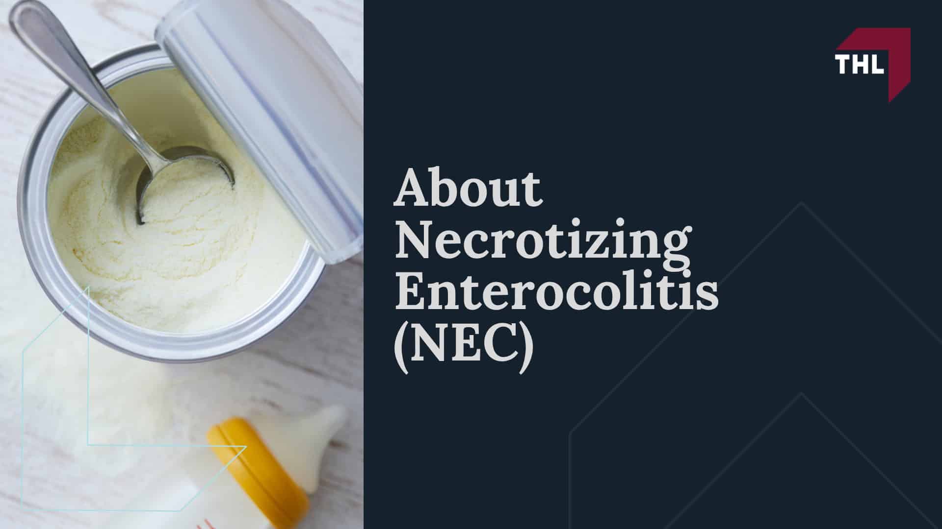 Overview of the NEC Baby Formula Lawsuits; Current NEC Lawsuit Status; What is the NEC Infant Formula MDL; What Baby Formula Brands are Included in NEC Lawsuits; Meet Our Team of Experienced NEC Lawyers; About Necrotizing Enterocolitis (NEC)
