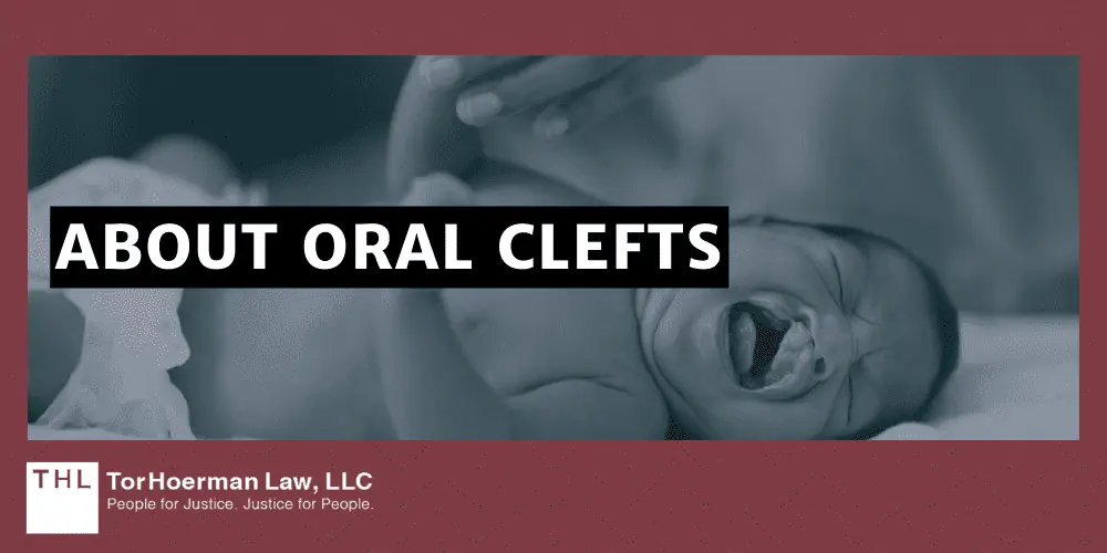 About Oral Clefts