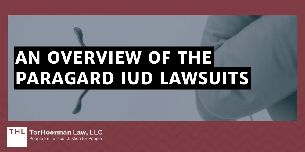 Do I Qualify for the Paragard Injury Lawsuit; Paragard Injury Lawsuit; Paragard Lawsuit; Paragard IUD Lawsuit; Paragard Lawsuits; Paragard IUD Lawsuits; Paragard Lawyers; An Overview Of The Paragard IUD Lawsuits