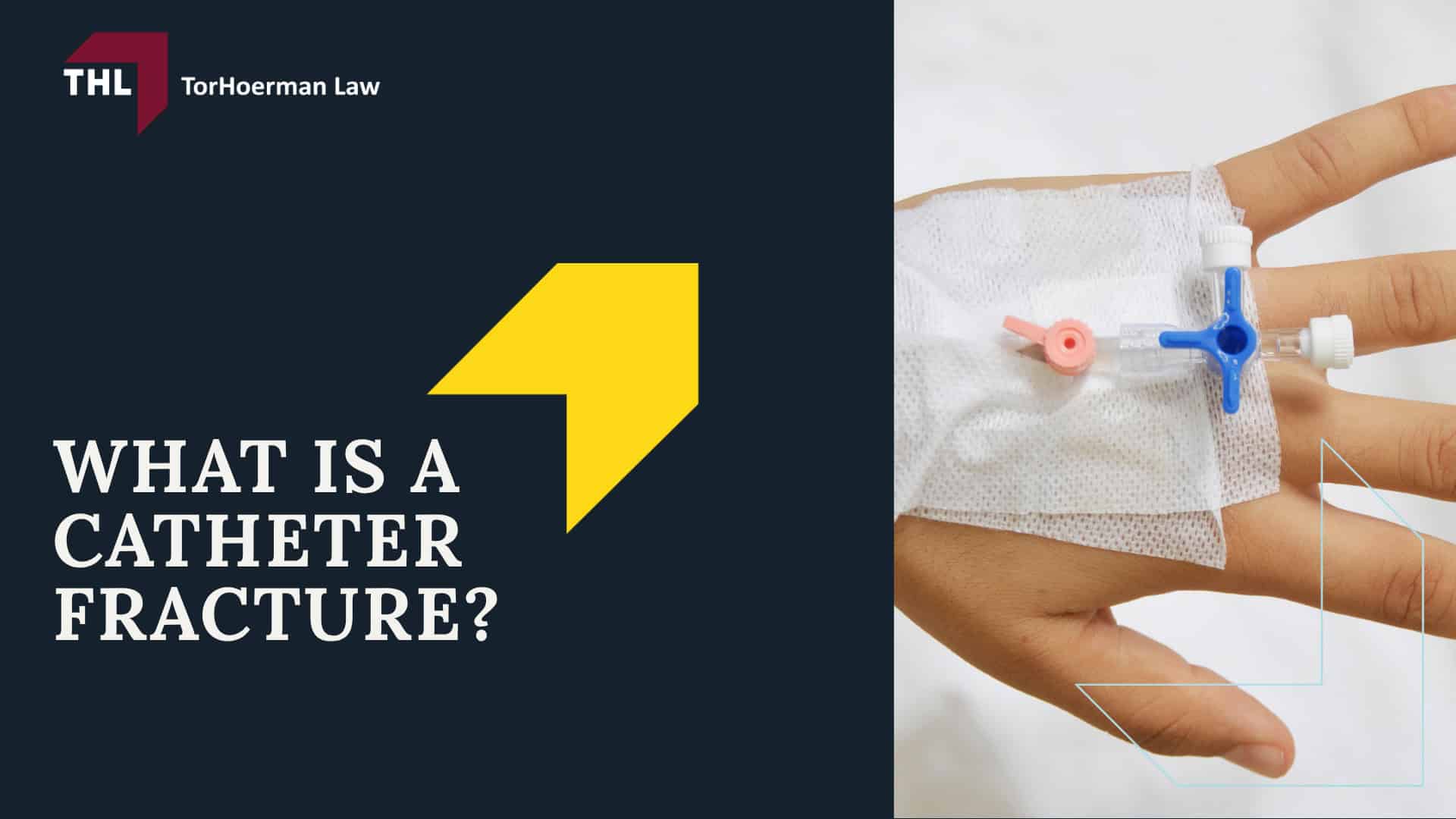 What You Need To Know About the Bard PowerPort Device; What Is the Bard PowerPort Used For; Who Uses the Bard PowerPort Device; Bard PowerPort Health Effects and Potential Life Threatening Complications; Bard PowerPort Catheter Fracture Lawsuit - What Is a Catheter Fracture_ - torhoerman law