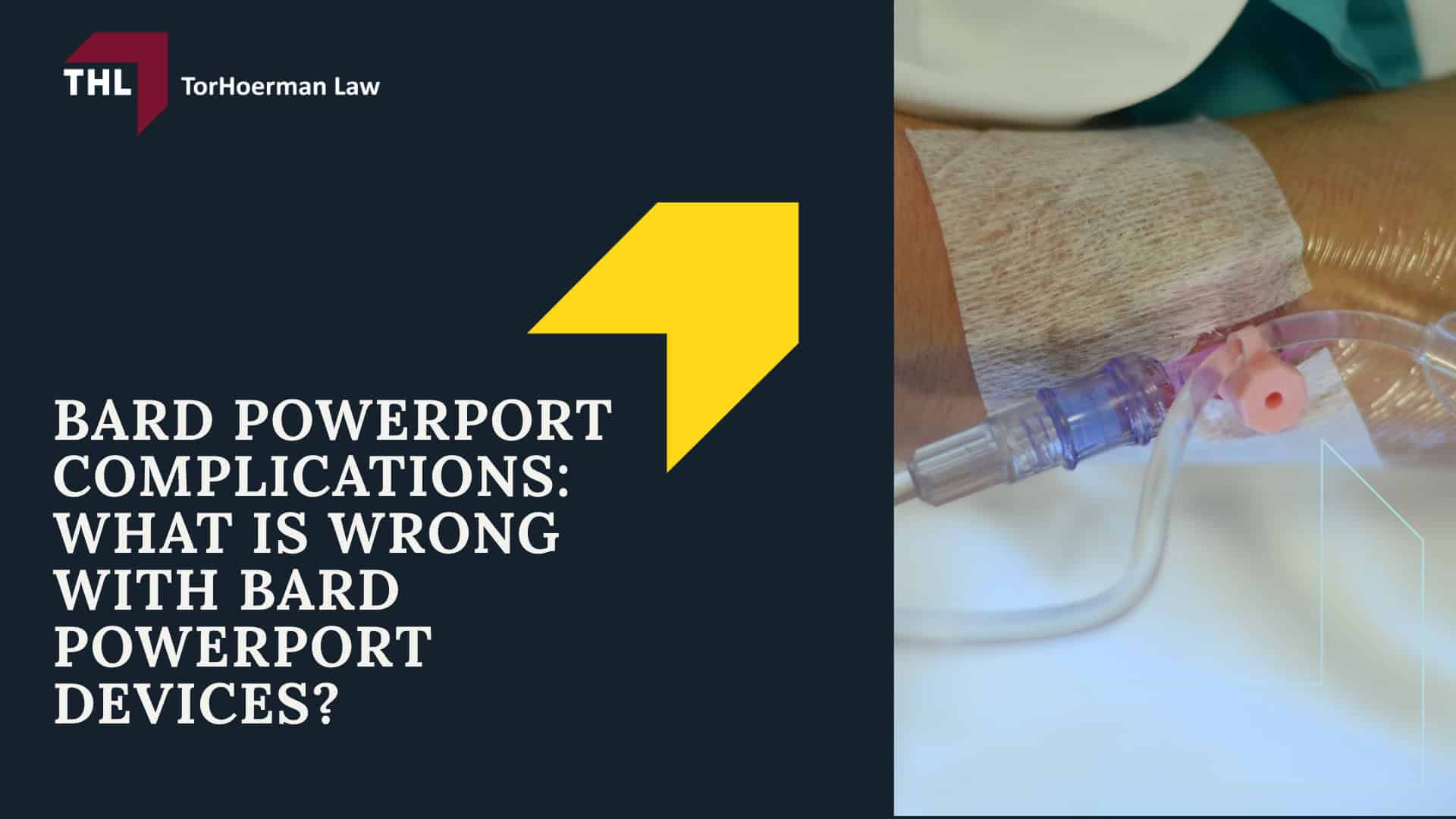 Bard PowerPort Device Linked to Fracture, Migration, and Thrombosis; What Is the Bard PowerPort Device; What are Port Catheters Used For; Bard PowerPort Catheter Fracture Lawsuit - What Is the Bard PowerPort Used For_ - torhoerman law