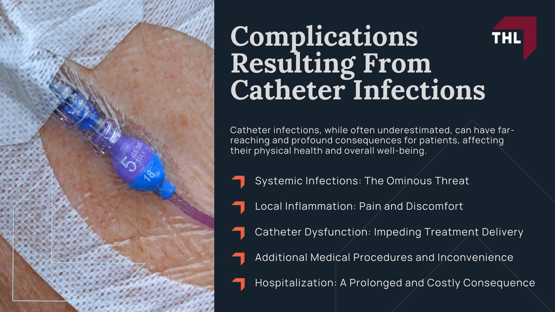 Bard PowerPort Catheter Infection Lawsuit - The Bard PowerPort Device_ A Brief Overview - torhoerman law; Bard PowerPort Catheter Infection Lawsuit - Bard PowerPort Complications - torhoerman law; Bard PowerPort Catheter Infection Lawsuit - Infections Caused by Defective Bard PowerPort Catheter Devices - torhoerman law; Bard PowerPort Catheter Infection Lawsuit - Why Do Catheter Infections Occur With Bard PowerPort Devices_ - torhoerman law; Bard PowerPort Catheter Infection Lawsuit - Complications Resulting From Catheter Infections - torhoerman law