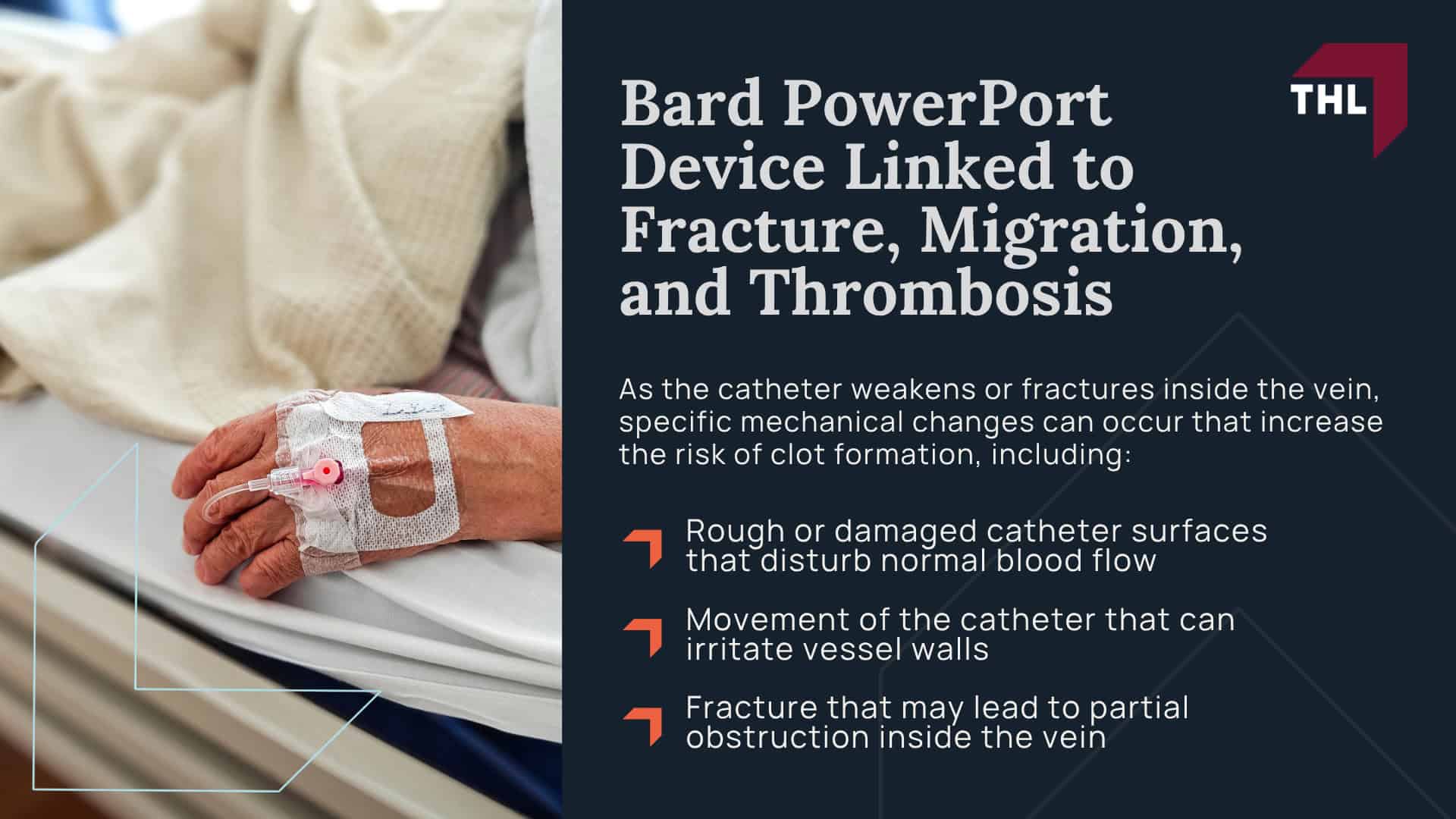 Bard PowerPort Device Linked to Fracture, Migration, and Thrombosis