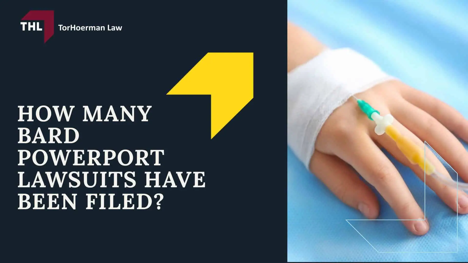 Breast Mesh Lawsuit - What Bard PowerPort Devices are Named in the Lawsuit_ - torhoerman law; Breast Mesh Lawsuit - Bard PowerPort Lawsuit Updates and Overview - torhoerman law; Breast Mesh Lawsuit - What Is the Bard PowerPort Device and Why Are Lawsuits Being Filed_ - torhoerman law; Breast Mesh Lawsuit - Reports of Device Defects and Patient Harm - torhoerman law; Breast Mesh Lawsuit - How Many Bard PowerPort Lawsuits Have Been Filed_ Current Status of the Bard PowerPort MDL - torhoerman law