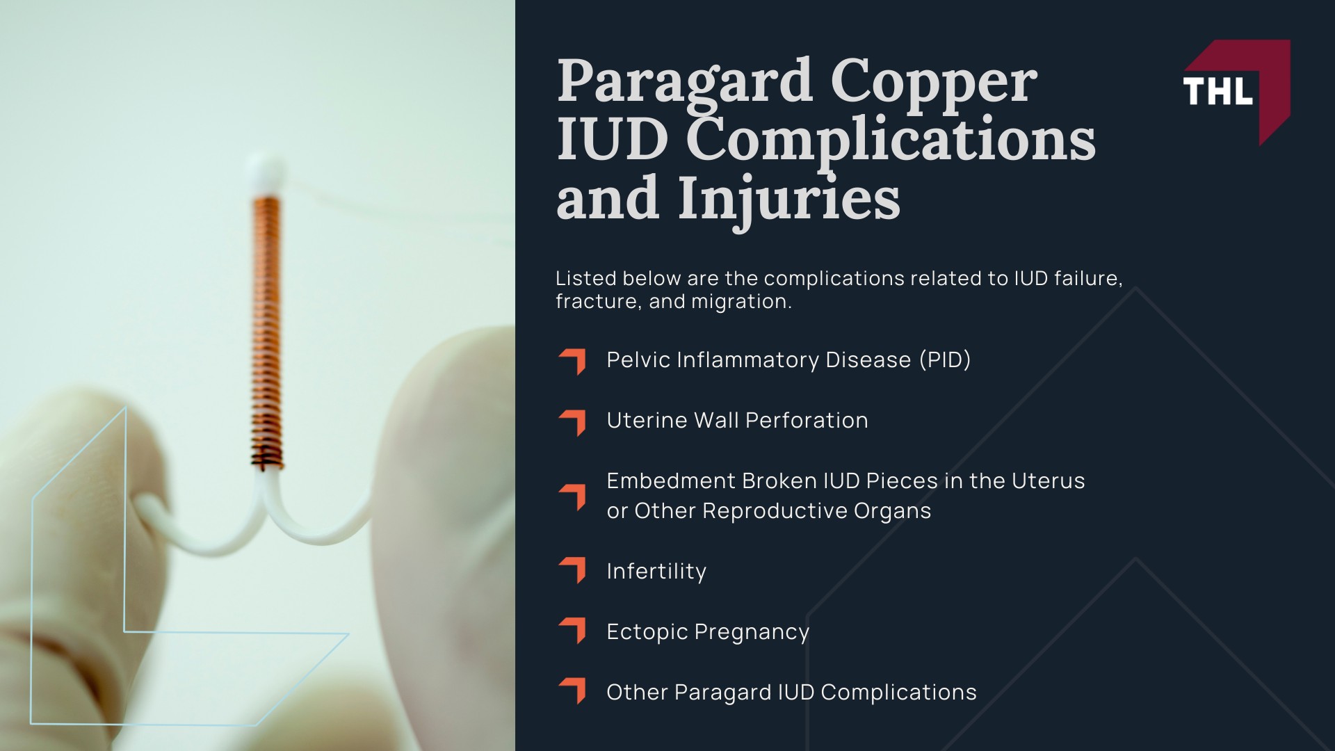 FAQ Do I Qualify for the Paragard Injury Lawsuit - An Overview of the Paragard IUD Lawsuits - torhoerman law; FAQ Do I Qualify for the Paragard Injury Lawsuit - The Defendants in the Paragard IUD Lawsuits - torhoerman law; FAQ Do I Qualify for the Paragard Injury Lawsuit - Recent Developments in the Paragard Lawsuits - torhoerman law; FAQ Do I Qualify for the Paragard Injury Lawsuit - Paragard Copper IUD Complications and Injuries - torhoerman law