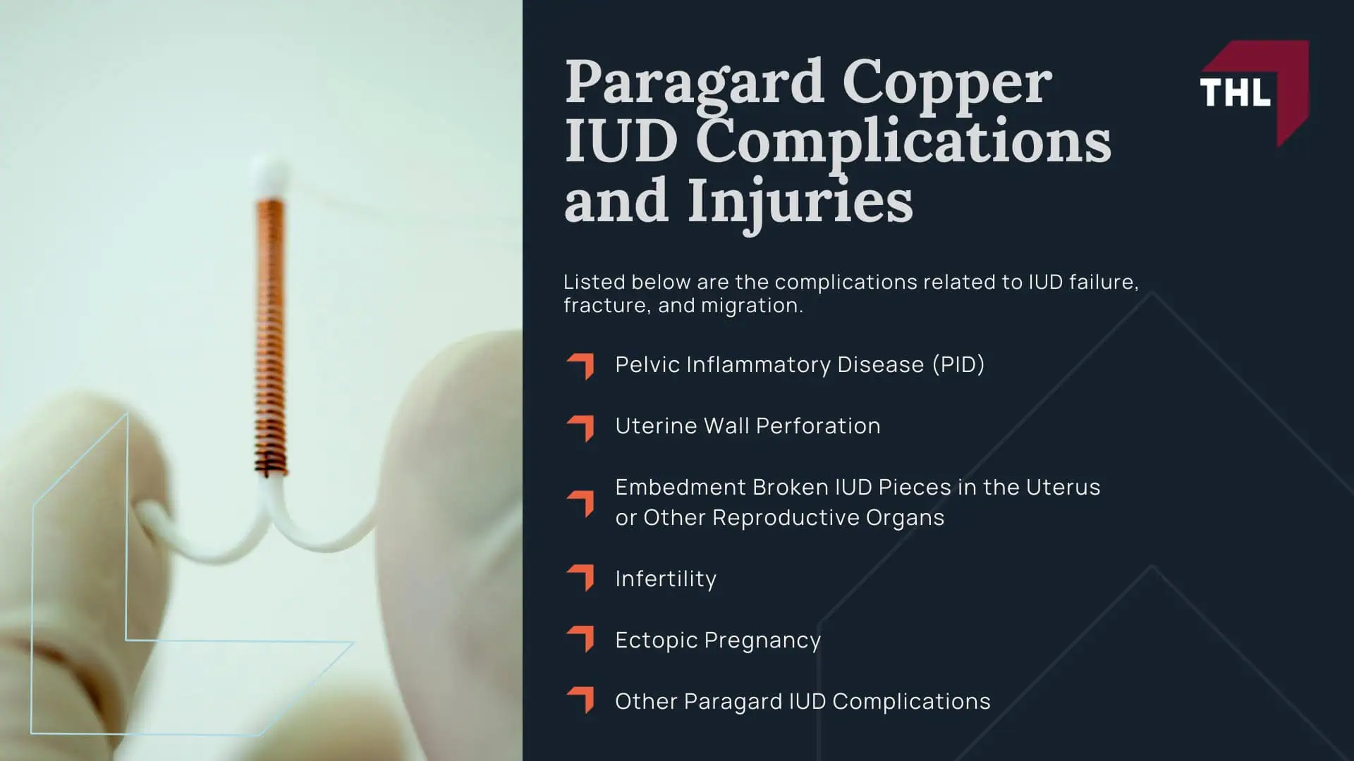 FAQ Do I Qualify for the Paragard Injury Lawsuit - An Overview of the Paragard IUD Lawsuits - torhoerman law; FAQ Do I Qualify for the Paragard Injury Lawsuit - The Defendants in the Paragard IUD Lawsuits - torhoerman law; FAQ Do I Qualify for the Paragard Injury Lawsuit - Recent Developments in the Paragard Lawsuits - torhoerman law; FAQ Do I Qualify for the Paragard Injury Lawsuit - Paragard Copper IUD Complications and Injuries - torhoerman law