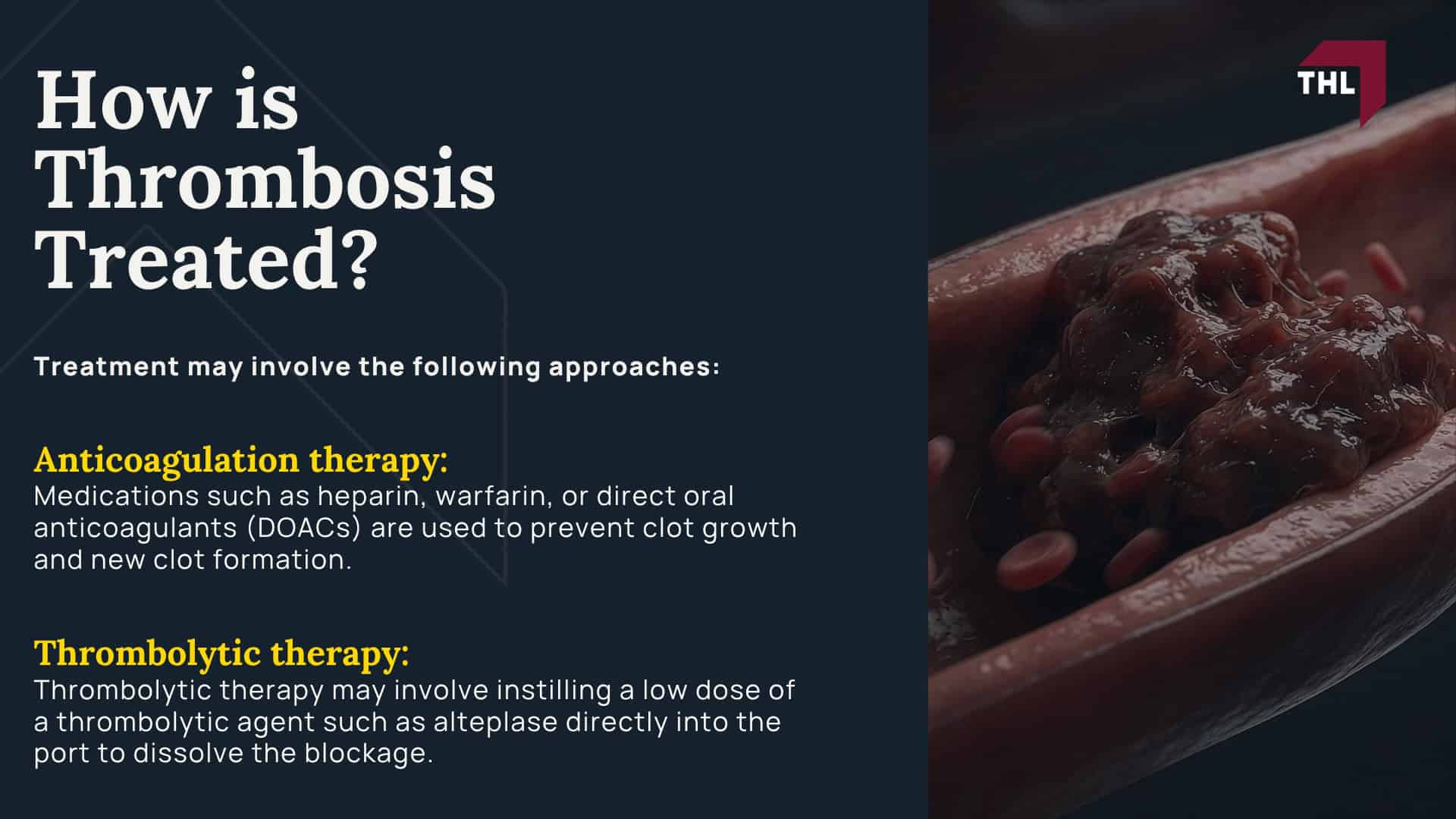 Bard PowerPort Device Linked to Fracture, Migration, and Thrombosis; What Is the Bard PowerPort Device; What are Port Catheters Used For; Bard PowerPort Catheter Fracture Lawsuit - What Is the Bard PowerPort Used For_ - torhoerman law;  How is Thrombosis Treated