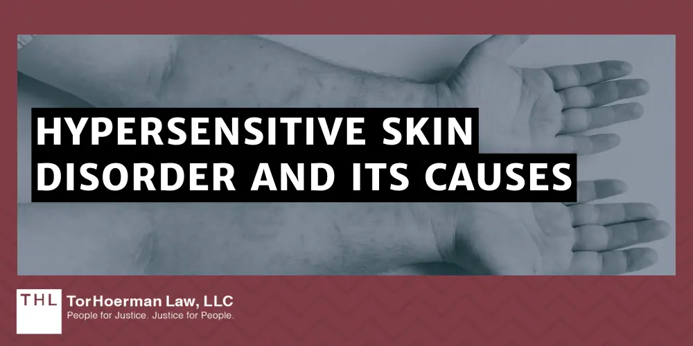 Hypersensitive Skin Disorder And Its Causes