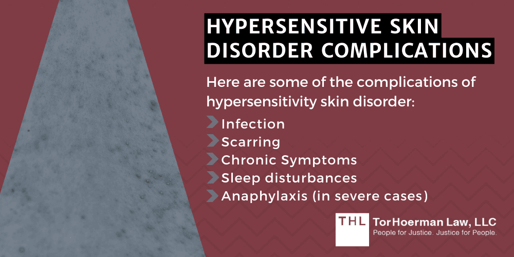 Camp Lejeune Hypersensitive Skin Disorder Lawsuit; Camp Lejeune Lawsuit; Camp Lejeune Water Contamination Lawsuit; Camp Lejeune Lawyers; Camp Lejeune Justice Act; Hypersensitive Skin Disorder Linked to Contaminated Drinking Water at Camp Lejeune; About Hypersensitive Skin Disorder; Hypersensitive Skin Disorder And Its Causes; Hypersensitive Skin Disorder Complications