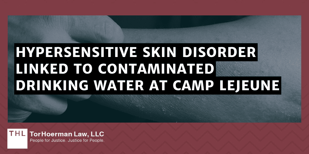 Camp Lejeune Hypersensitive Skin Disorder Lawsuit; Camp Lejeune Lawsuit; Camp Lejeune Water Contamination Lawsuit; Camp Lejeune Lawyers; Camp Lejeune Justice Act; Hypersensitive Skin Disorder Linked to Contaminated Drinking Water at Camp Lejeune