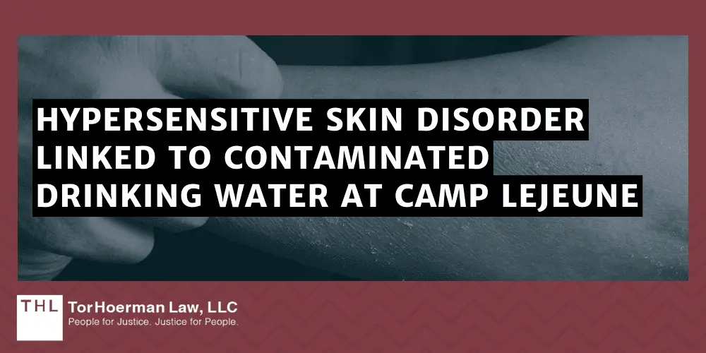 Hypersensitive Skin Disorder Linked to Contaminated Drinking Water at Camp Lejeune