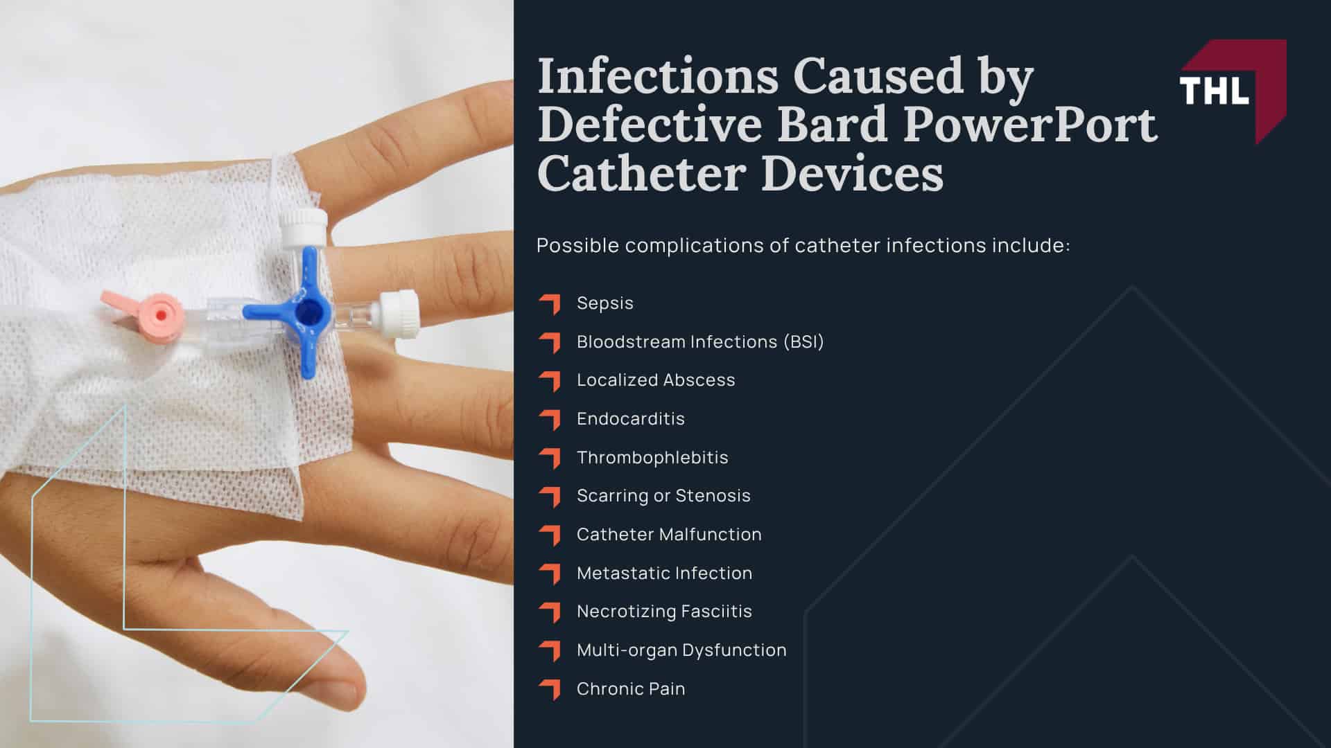 Infections Caused by Defective Bard PowerPort Catheter Devices; Infections Caused by Defective Bard PowerPort Catheter Devices