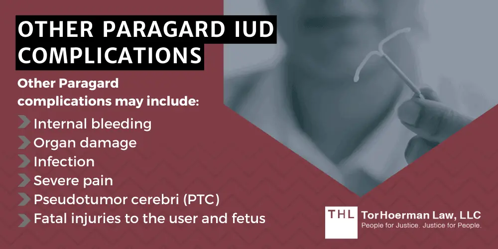 Do I Qualify for the Paragard Injury Lawsuit; Paragard Injury Lawsuit; Paragard Lawsuit; Paragard IUD Lawsuit; Paragard Lawsuits; Paragard IUD Lawsuits; Paragard Lawyers; An Overview Of The Paragard IUD Lawsuits; The Defendants In The Paragard IUD Lawsuits; Recent Developments In The Paragard Lawsuits; Paragard Copper IUD Complications And Injuries; Other Paragard IUD Complications