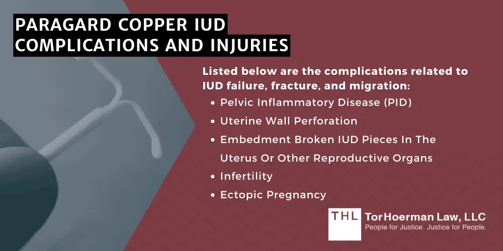 Do I Qualify for the Paragard Injury Lawsuit; Paragard Injury Lawsuit; Paragard Lawsuit; Paragard IUD Lawsuit; Paragard Lawsuits; Paragard IUD Lawsuits; Paragard Lawyers; An Overview Of The Paragard IUD Lawsuits; The Defendants In The Paragard IUD Lawsuits; Recent Developments In The Paragard Lawsuits; Paragard Copper IUD Complications And Injuries