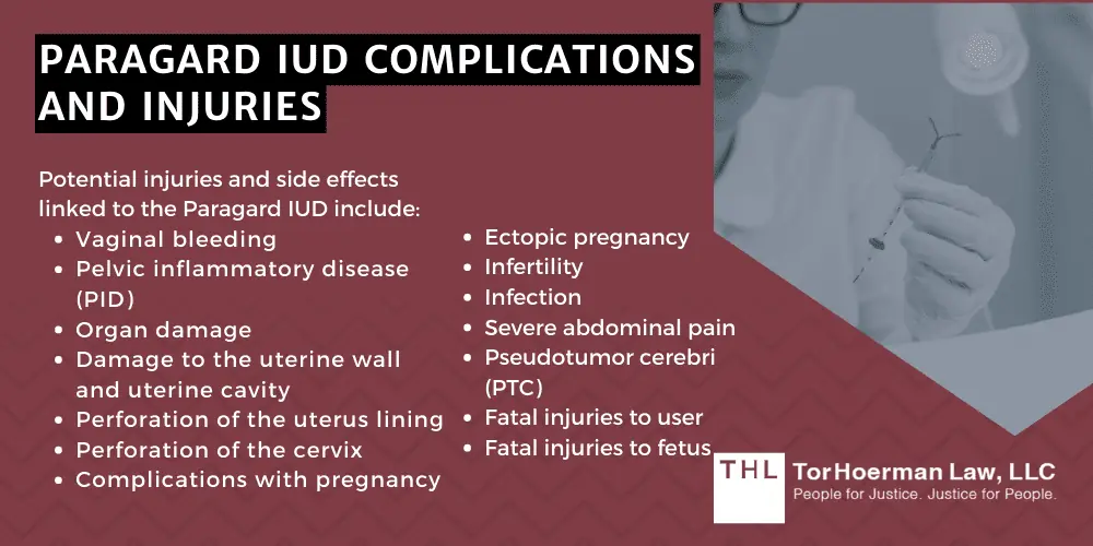 Paragard IUD Complications And Injuries